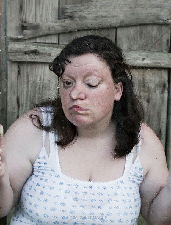 The Ugly Truth di Rut Mackel, quando la fotografia non è bellezza